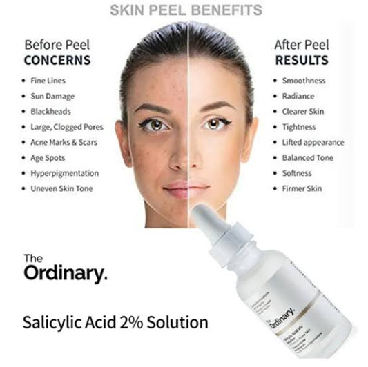 The Ordinary Salicylic Acid 2%