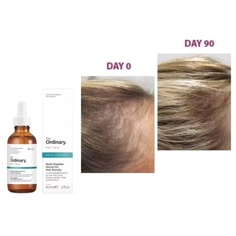 The Ordinary Multi-Peptide – سيروم لتقوية وإنبات الشعر