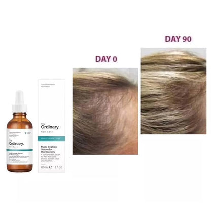 The Ordinary Multi-Peptide – سيروم لتقوية وإنبات الشعر