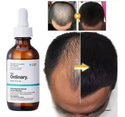 The Ordinary Multi-Peptide – سيروم لتقوية وإنبات الشعر