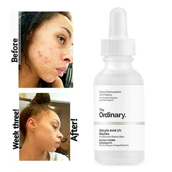 The Ordinary Salicylic Acid 2%
